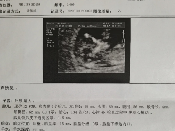 孕三个月已验证生女儿检查图片，NT值1.2mm是男是女快看
